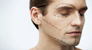 Популярність пластичних операцій серед чоловіків зросла вдвічі